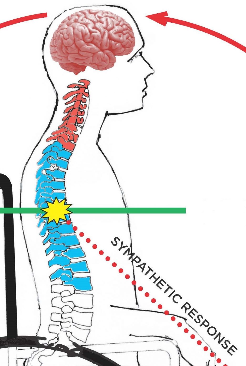 autonomic-dysreflexia-national-rehabilitation-hospital